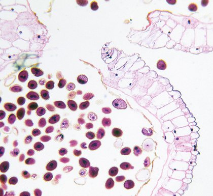 Histologisches Präparat unter dem Mikroskop – Zellstruktur und Gewebeaufbau in der mikroskopischen Analyse sichtbar