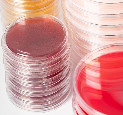 Gestapelte Petrischalen mit verschiedenfarbigem Agar, darunter rot, orange und dunkelrotbraun