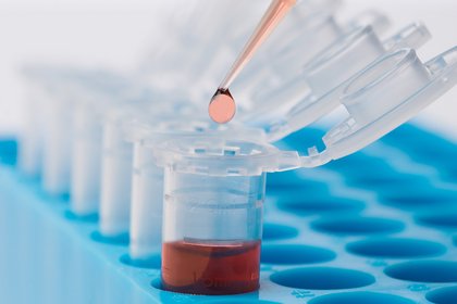 Pipette und Probenröhrchen als Laborverbrauchsmaterial für Analysen in der Umweltanalytik.