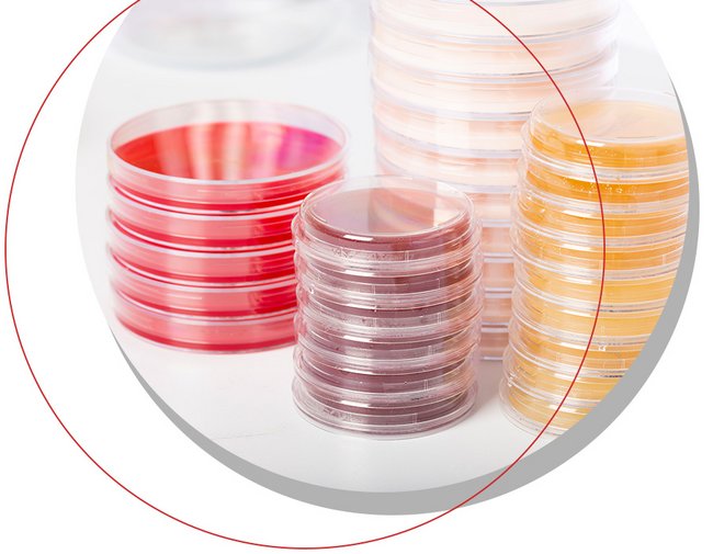 Fertigplatten für die Mikrobiologie – vorgefüllte Agarplatten für Hygieneüberwachung, Lebensmittel- und Umweltanalytik